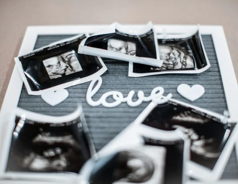 Calm confidence through pregnancy reassurance scans in Perth