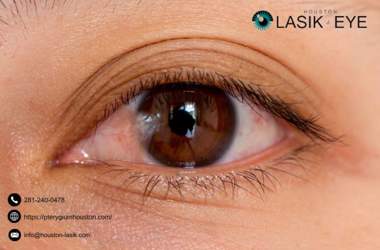 Practical guidance on using eye drops for pterygium Practical guidance on using eye drops for pterygium