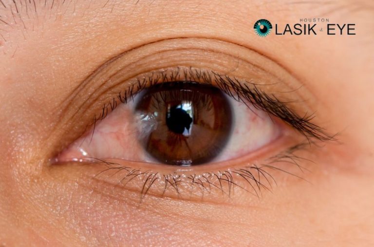 Practical guidance on managing pterygium and its treatment options Practical guidance on managing pterygium and its treatment options