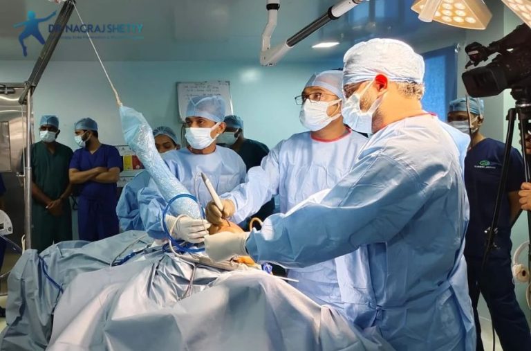 Top Choices for Shoulder Arthroscopy in India and Mumbai
