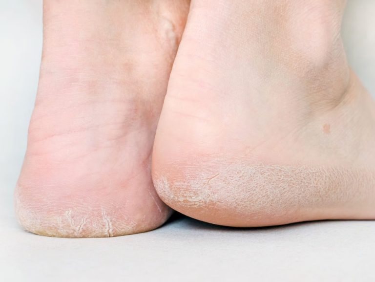 Compassionate podiatry care from a Houston team Compassionate podiatry care from a Houston team